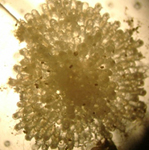 The bryozoan Lichenopora verrucaria